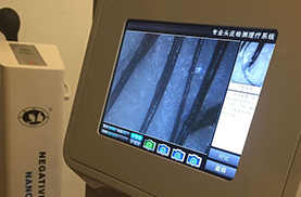 头皮检测显示设备