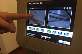 专业头皮检测设备展示