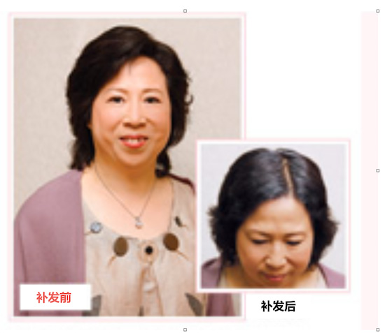 林太太假发织发补发前后对比图.jpg.jpg 林太太假发织发补发前后对比图.jpg.jpg