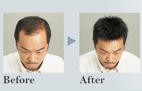 高难度小平头寸头假发方案