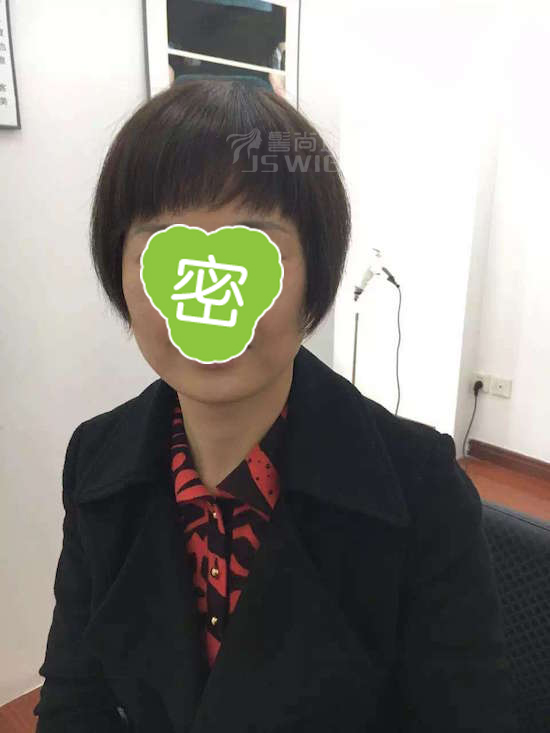 头顶头发稀疏头顶补发顾客李女士的感谢话分享.jpg