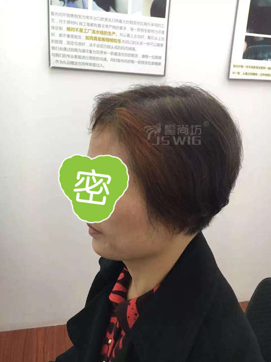 头顶头发稀疏头顶补发顾客李女士的感谢话分享1.jpg
