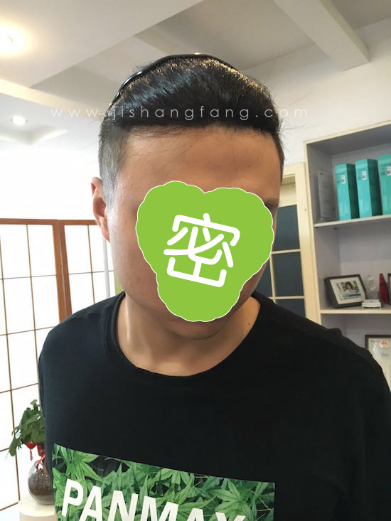 在使用增发补发制品上有任何问题直接向您的髻尚坊增补发客服咨询.jpg