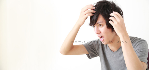 【男性脱发种类有哪些？】男性脱发从大方向来划分只要分为以下几种2.jpg