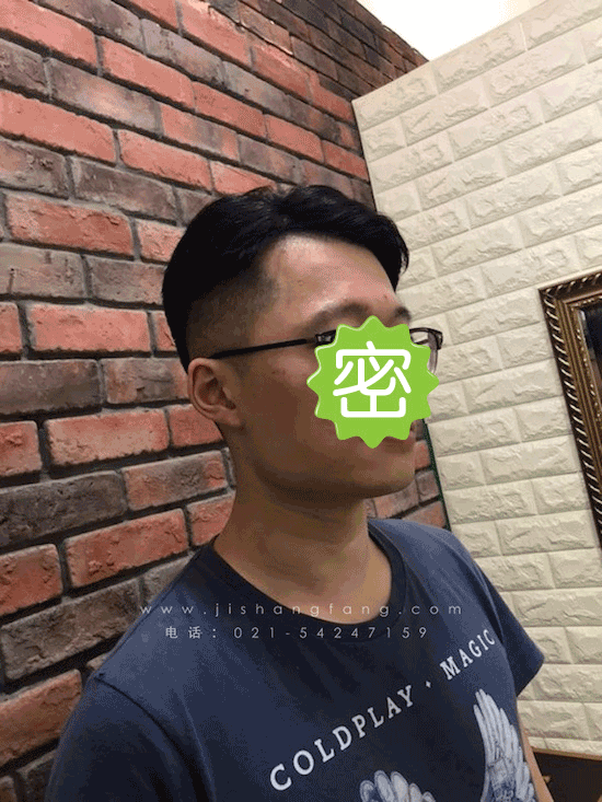 分线明显头顶部头发稀疏立即搞定2.png