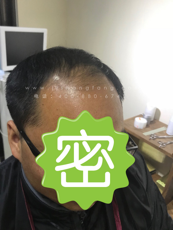 髻尚坊男士隐形增发零感特薄的紧贴设计经得起长时间考验且仿真头皮高度透气绝无局促感2.jpg 髻尚坊男士隐形增发零感特薄的紧贴设计经得起长时间考验且仿真头皮高度透气绝无局促感