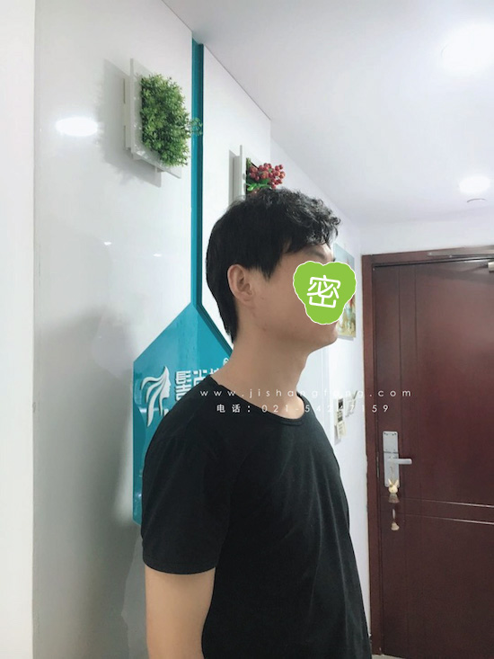 你有勇气掉发十年却没勇气来尝试1.jpg 你有勇气掉发十年却没勇气来尝试1