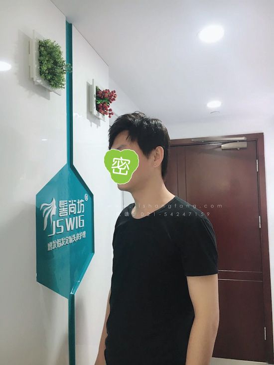 你有勇气掉发十年却没勇气来尝试.jpg 你有勇气掉发十年却没勇气来尝试