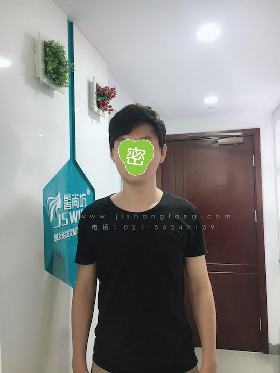 你有勇气掉发十年却没勇气来尝试2.jpg 你有勇气掉发十年却没勇气来尝试2