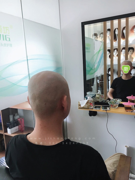 你有勇气掉发十年却没勇气来尝试3.jpg 你有勇气掉发十年却没勇气来尝试3