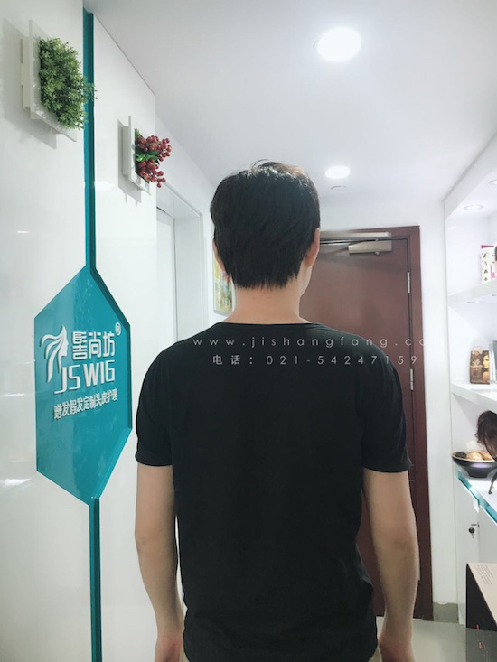 你有勇气掉发十年却没勇气来尝试4.jpg 你有勇气掉发十年却没勇气来尝试4