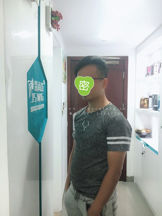 你有勇气掉发十年却没勇气来尝试6.jpg 你有勇气掉发十年却没勇气来尝试6