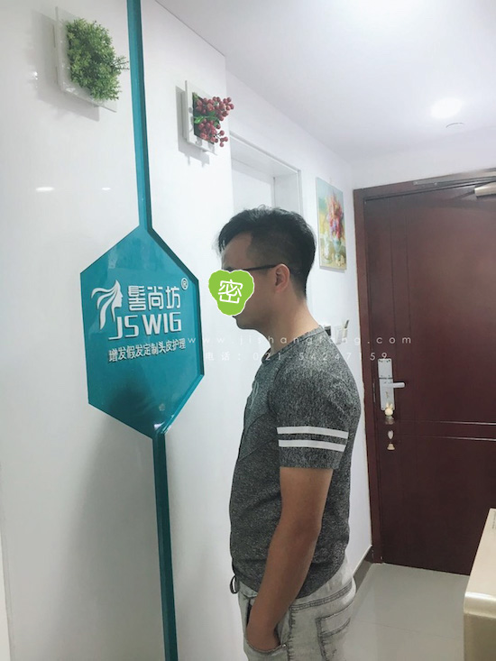 你有勇气掉发十年却没勇气来尝试8.jpg 你有勇气掉发十年却没勇气来尝试8