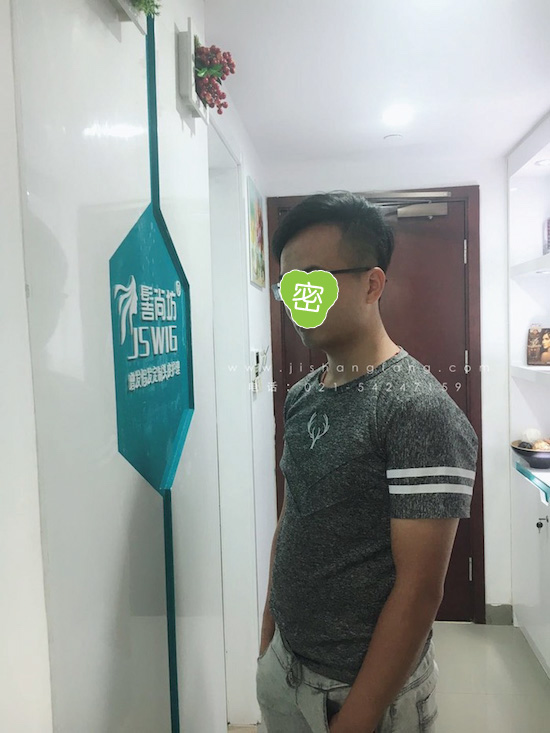 你有勇气掉发十年却没勇气来尝试7.jpg 你有勇气掉发十年却没勇气来尝试7