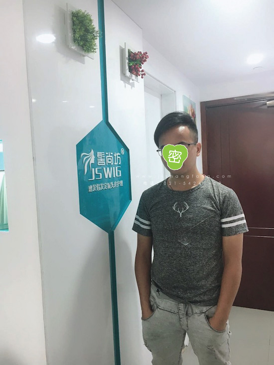 你有勇气掉发十年却没勇气来尝试9.jpg 你有勇气掉发十年却没勇气来尝试9