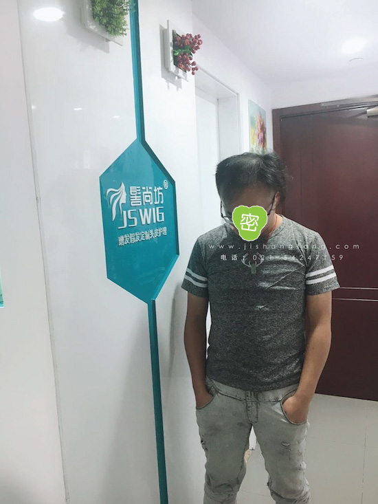 你有勇气掉发十年却没勇气来尝试10.jpg 你有勇气掉发十年却没勇气来尝试10