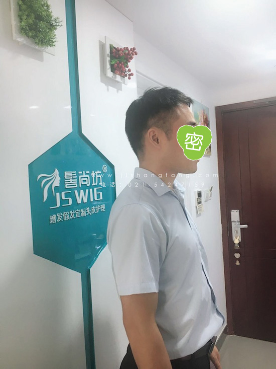 你有勇气掉发十年却没勇气来尝试11.jpg 你有勇气掉发十年却没勇气来尝试11