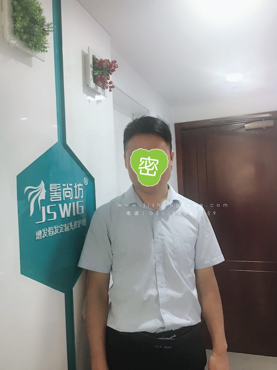 你有勇气掉发十年却没勇气来尝试13.jpg 你有勇气掉发十年却没勇气来尝试13