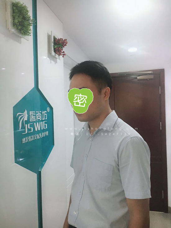 你有勇气掉发十年却没勇气来尝试12.jpg 你有勇气掉发十年却没勇气来尝试12