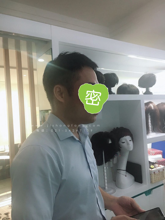 你有勇气掉发十年却没勇气来尝试14.jpg 你有勇气掉发十年却没勇气来尝试14