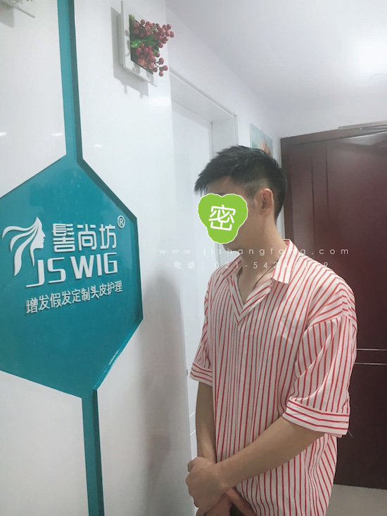 你有勇气掉发十年却没勇气来尝试16.jpg 你有勇气掉发十年却没勇气来尝试16