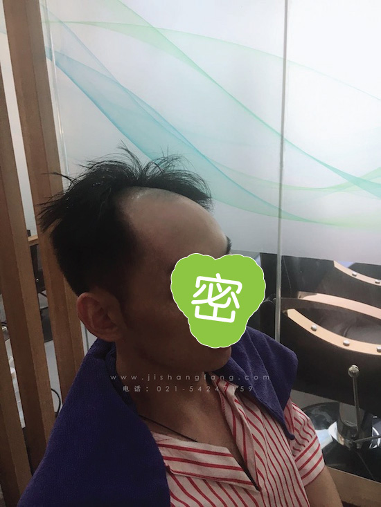 你有勇气掉发十年却没勇气来尝试18.jpg 你有勇气掉发十年却没勇气来尝试18