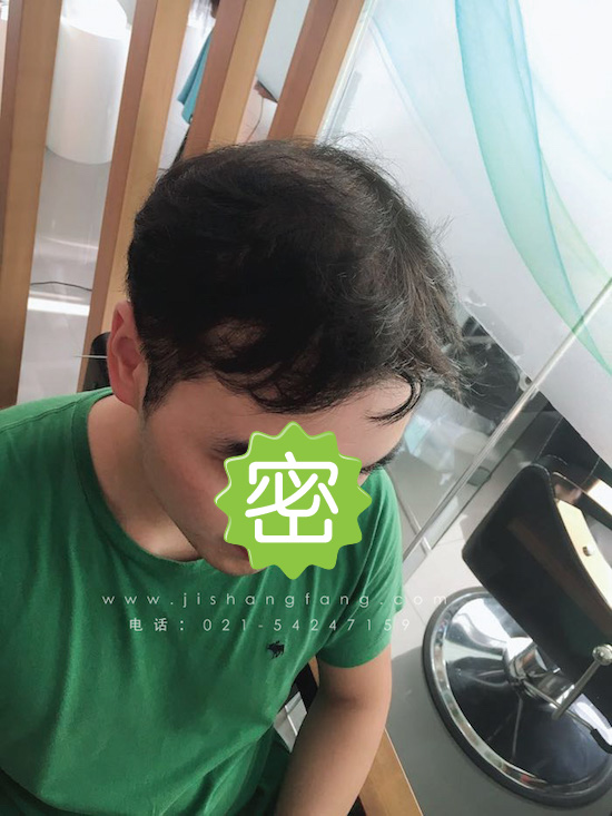 你有勇气掉发十年却没勇气来尝试19.jpg 你有勇气掉发十年却没勇气来尝试19