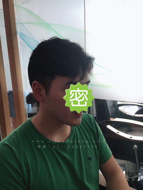 你有勇气掉发十年却没勇气来尝试20.jpg 你有勇气掉发十年却没勇气来尝试20