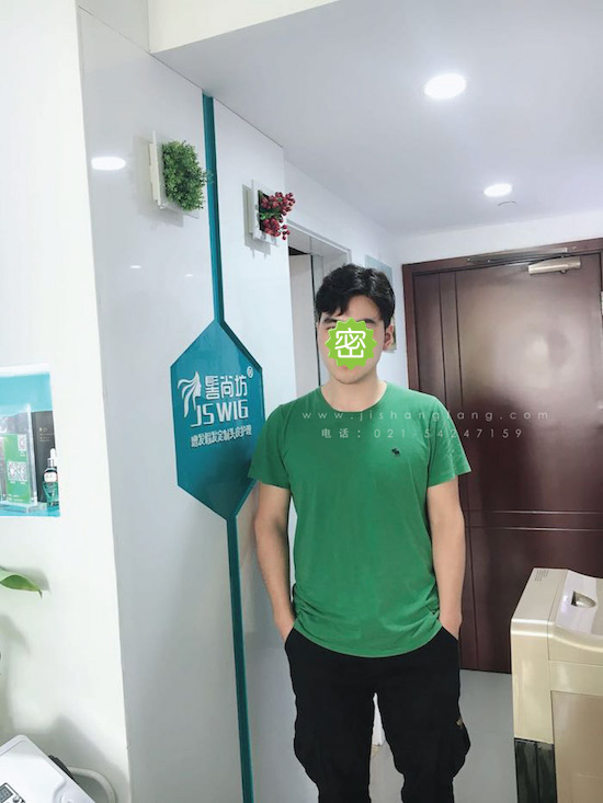 你有勇气掉发十年却没勇气来尝试21.jpg 你有勇气掉发十年却没勇气来尝试21