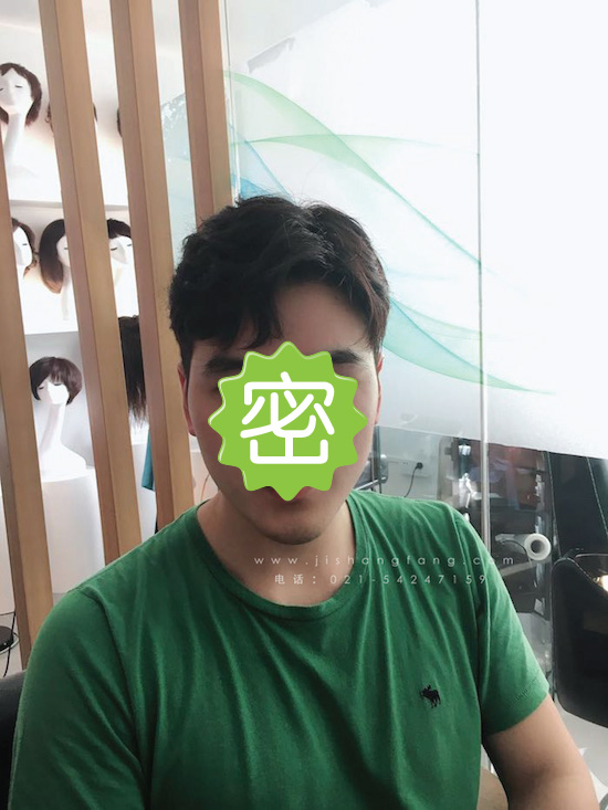 你有勇气掉发十年却没勇气来尝试22.jpg 你有勇气掉发十年却没勇气来尝试22