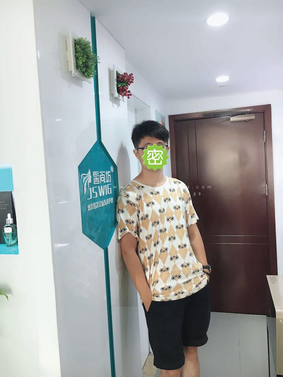 你有勇气掉发十年却没勇气来尝试28.jpg 你有勇气掉发十年却没勇气来尝试28