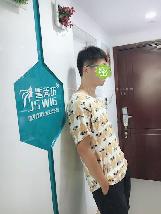 你有勇气掉发十年却没勇气来尝试29.jpg 你有勇气掉发十年却没勇气来尝试29