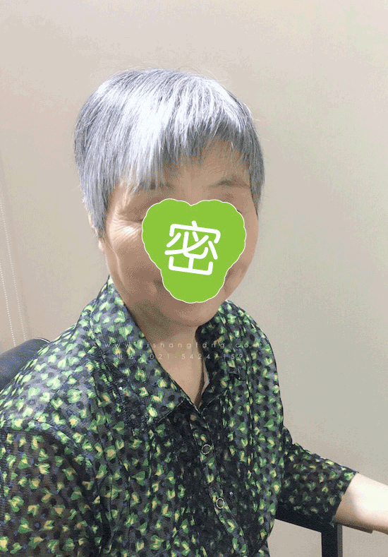 【白发多遮盖白发】髻尚坊女士头顶快速补发白发被天然的真人发覆盖