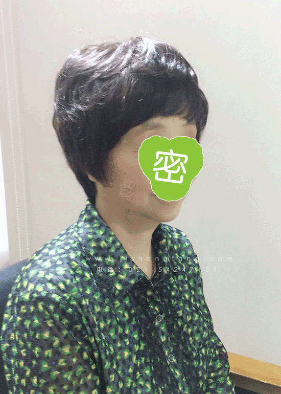 【白发多遮盖白发】髻尚坊女士头顶快速补发白发被天然的真人发覆盖