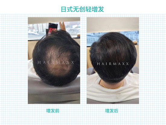 pphair-man02.jpg