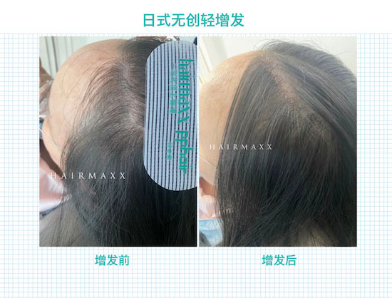 pphair-woman-59的副本-3.jpg