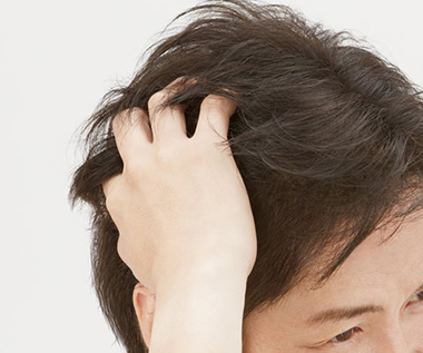 男士假发常见问题解答