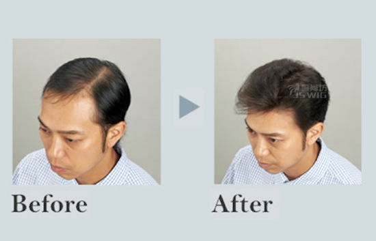 后背头油头男士隐形发解决方案