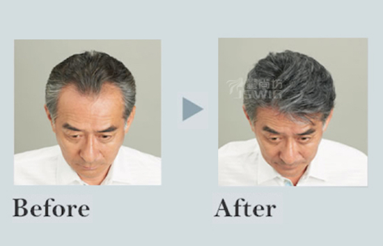 男士隐形增发白发苍发解决方案